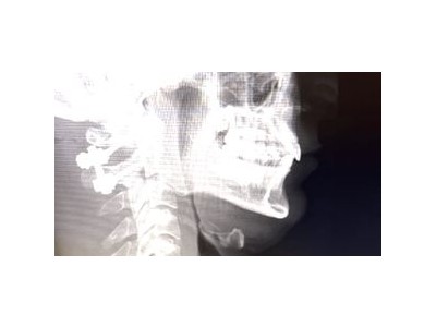 클린스만 주니어 5개월 전 팔레르모 경기서 놀라운 실수로 팀에 큰 타격 줬다